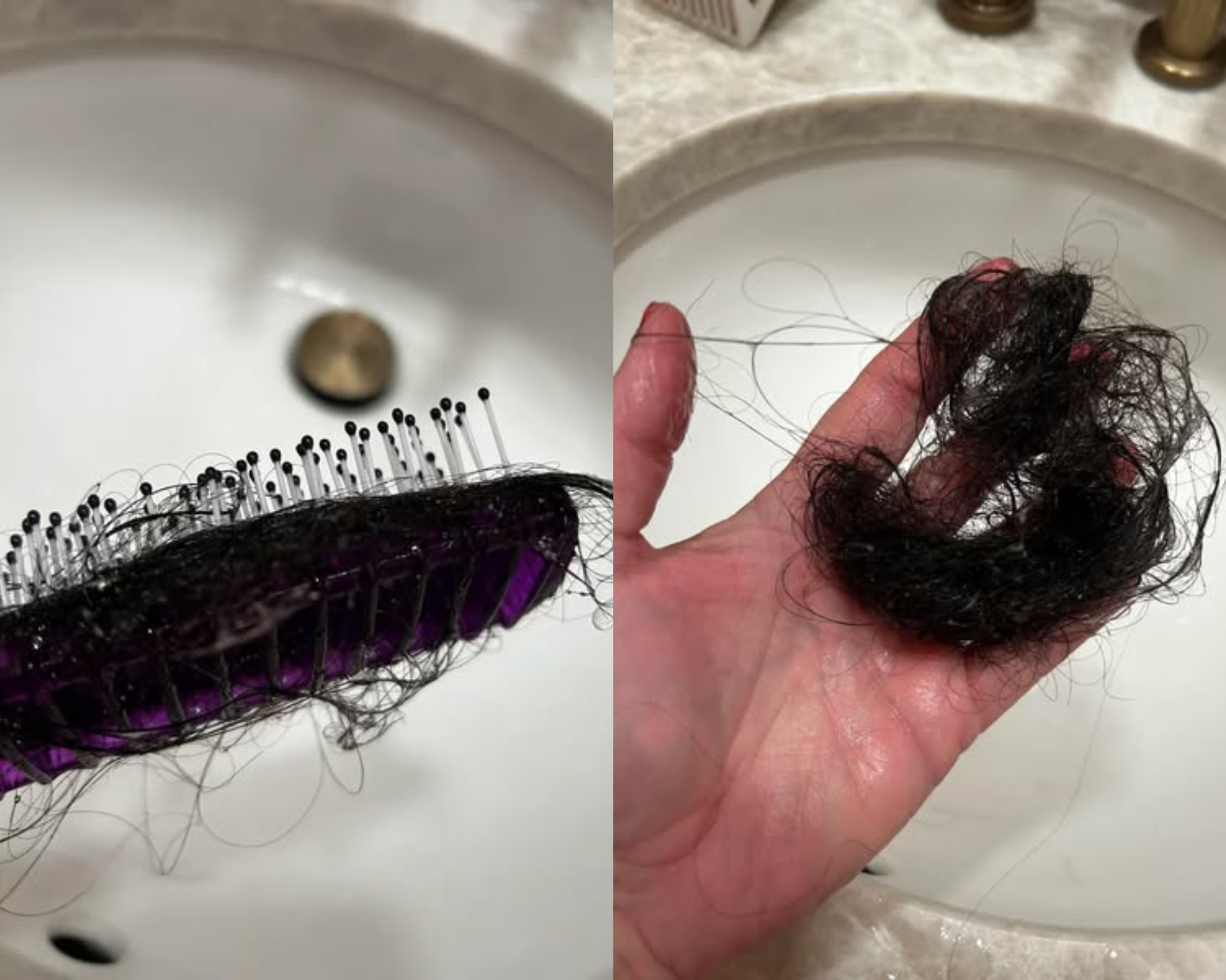 Hair loss — strands collected from a hairbrush