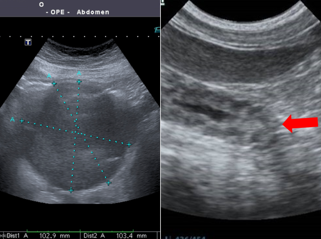 Abdominal imaging — pre/post ginger extract